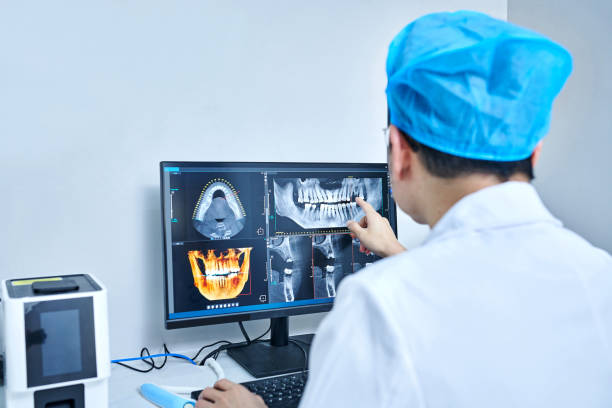 Best Dental Abscess Treatment in Albany, LA