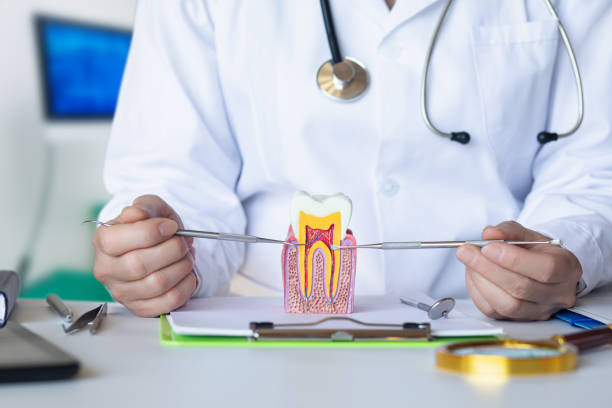 Best Knocked-Out Tooth (Avulsed Tooth) Treatment in Albany, LA